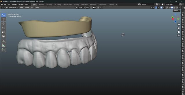 I will design professional Exocad dental restorations, implant cases and full arch workflows image 14
