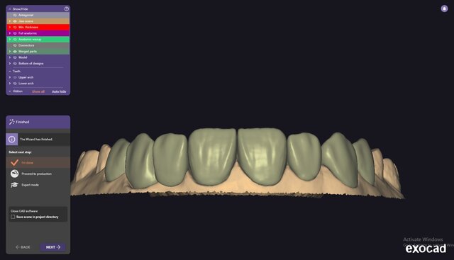 I will design professional Exocad dental restorations, implant cases and full arch workflows image 8