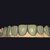 I will design professional Exocad dental restorations, implant cases and full arch workflows slider nav image 8