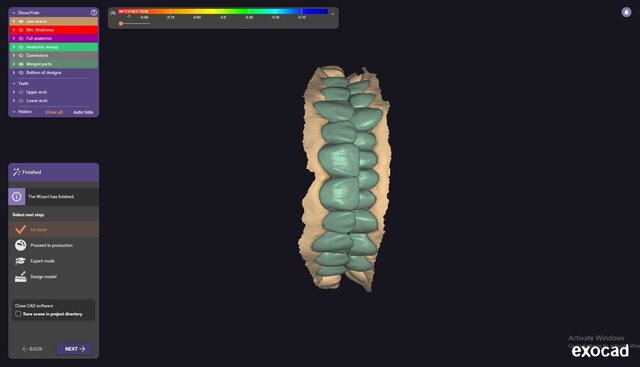 I will design professional Exocad dental restorations, implant cases and full arch workflows image 10