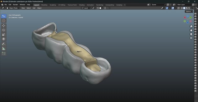 I will design professional Exocad dental restorations, implant cases and full arch workflows image 15