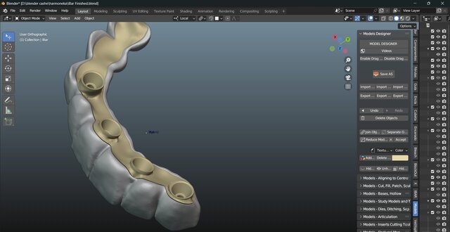 I will design professional Exocad dental restorations, implant cases and full arch workflows image 12