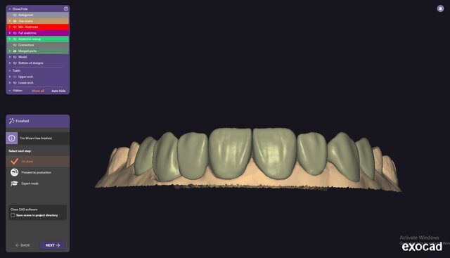 I will design professional Exocad dental restorations, implant cases and full arch workflows image 7