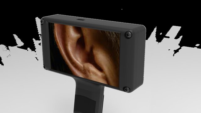 Product & Industrial Design & Prototyping| Wearable Medical Devices