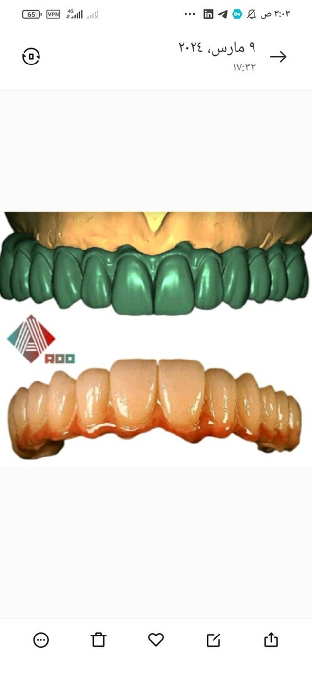 I offer CAD dental design & 3D modeling services for dentists image 1